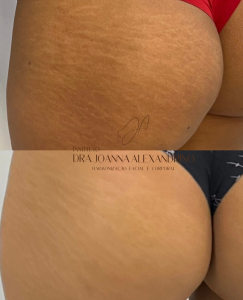 FullSizeRender